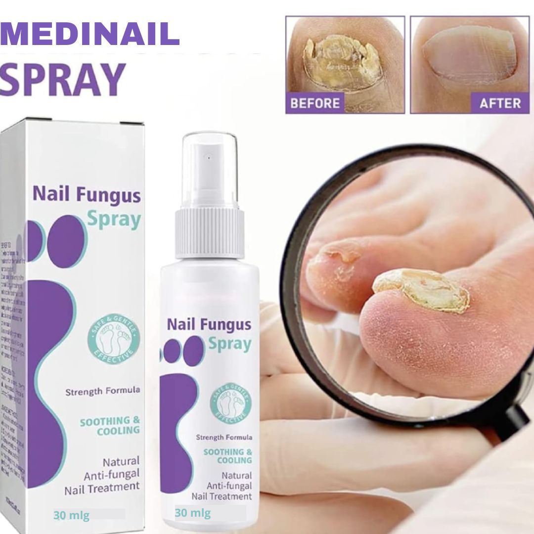 Medinail Spray 🔥 Miles ya lo usan. Tú puedes empezar hoy.